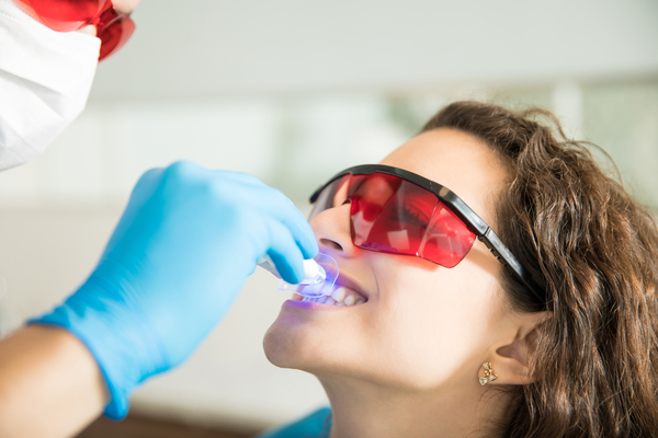 Blanqueamiento dental: tratamiento seguro